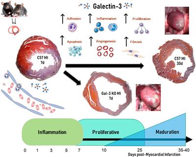 Unraveling the role of galectin-3 in cardiac pathology and physiology